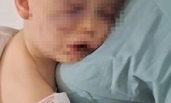 Aren bebeğe şiddet uygulayanlar gözaltında