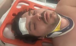 Darp edilen oyuncu dehşet anlarını anlattı: "Ölecektim"