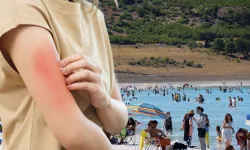 Türkiye’de et yiyen bakteri uyarısı! Bakanlıktan açıklama