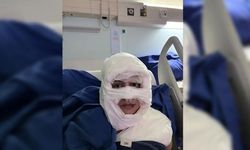 Kadıköy’de şoke eden şiddet: Kadını yaktı