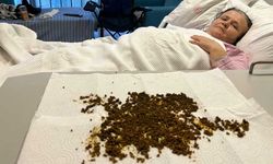 Türkiye’de nadiren görülen vaka!