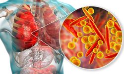 Zatürre aşısı ölüm riskini yüzde 80 azaltıyor