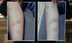 Özel okulda darp iddiası: