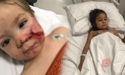 2 çocuk yaralanmıştı: Pitbull’un sahibi tutuklandı