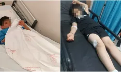 Gençlik Parkı’nda tüfek kazası: öğrenci bacağından yaralandı