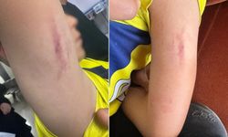 10 yaşındaki öğrenciye darp iddiası: Aile şikayetçi