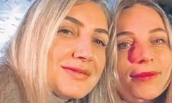 İBB soruşturmasında Derya Dağdeviren tahliye edildi