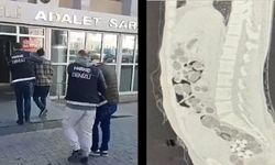 İstanbul'dan Denizli'ye midesinde 1.3 kilo uyuşturucu ile geldi