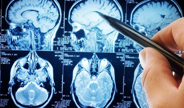 Yapay zekâ destekli kalem, Parkinson'u yüzde 95 başarıyla tespit etti