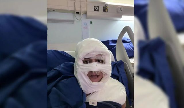 Kadıköy’de şoke eden şiddet: Kadını yaktı