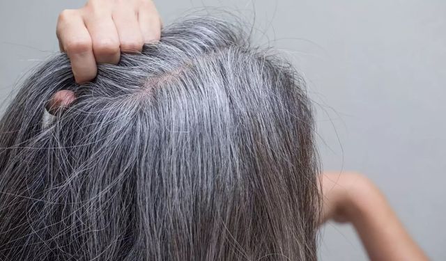 Genç yaşta beyaz saçın gizli gücü