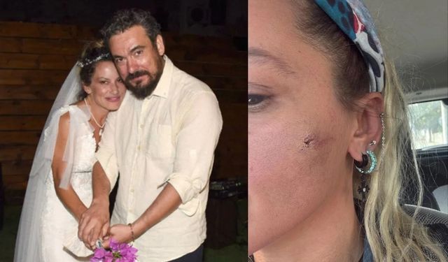 Yıldız Asyalı'nın eşi Demirci’den 'darp' iddiasına yanıt