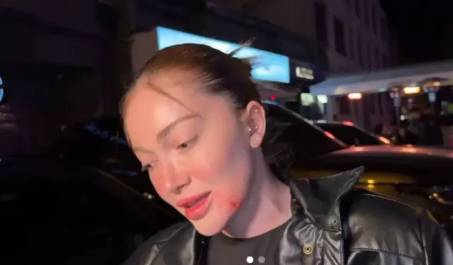 Danla Biliç’i darbeden eski sevgiliye 5 ay hapis cezası