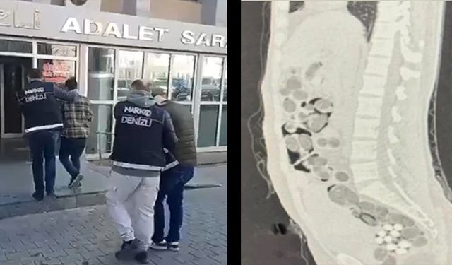 İstanbul'dan Denizli'ye midesinde 1.3 kilo uyuşturucu ile geldi