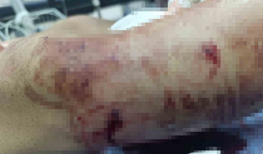 Muş’ta ayının saldırdığı çocuk yaralandı