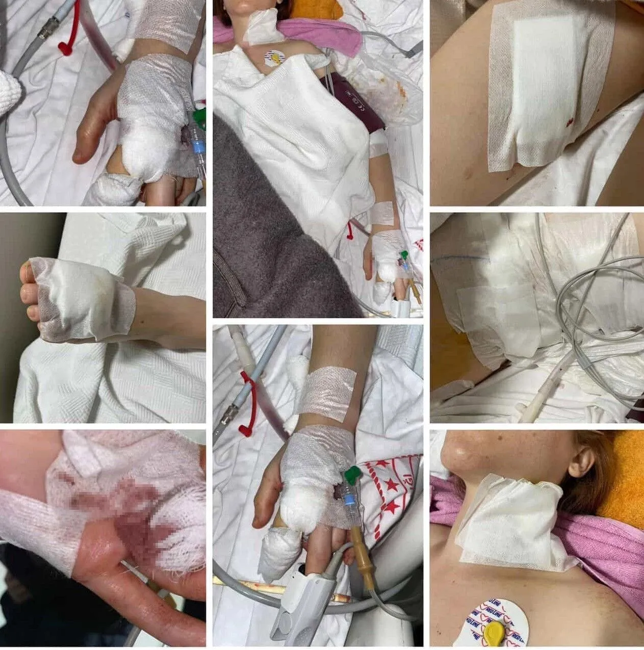 Izmir Bucada Genc Kadin Eski Kocasi Tarafindan Defalarca Bicaklandi5